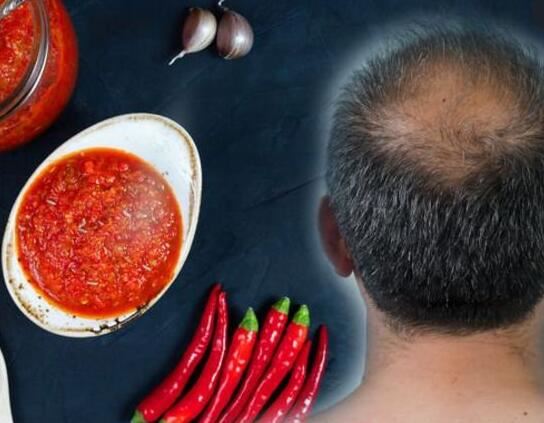 Capsaicin benefits for hair Capsaicin benefits for hair